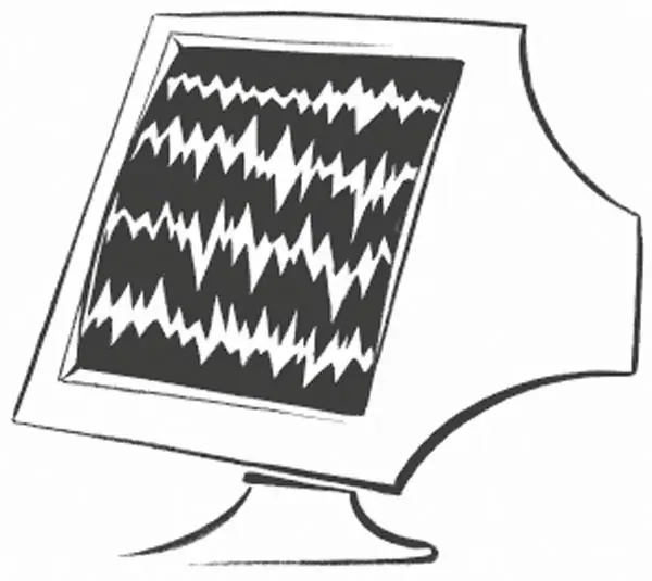 Cara menghilangkan kerlipan monitor